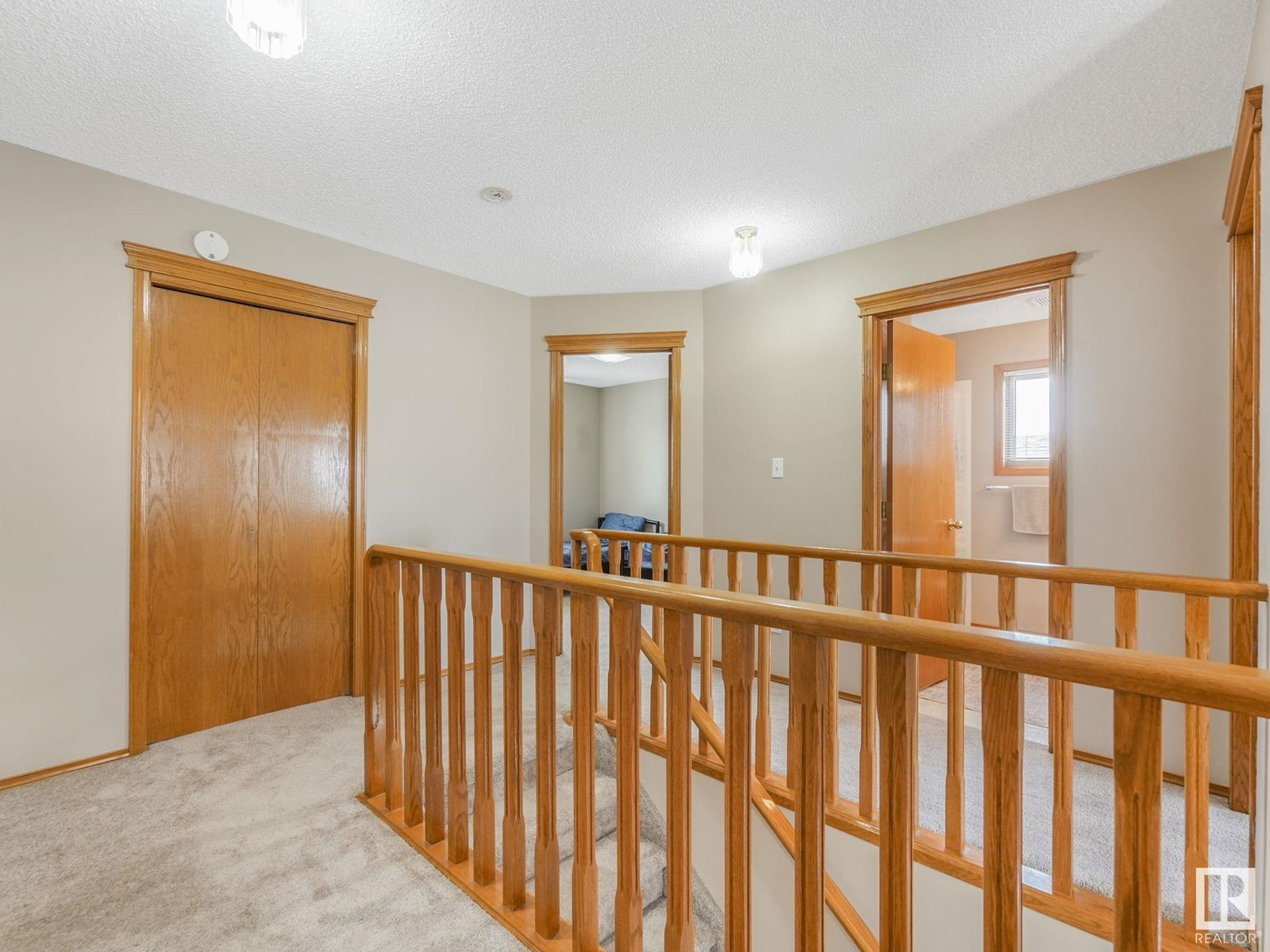 Photo 20 of 8515 157 Av Nw, Edmonton AB
