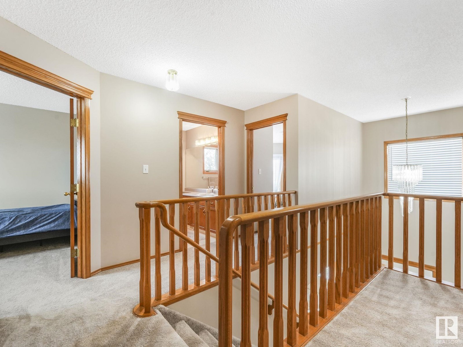Photo 19 of 8515 157 Av Nw, Edmonton AB