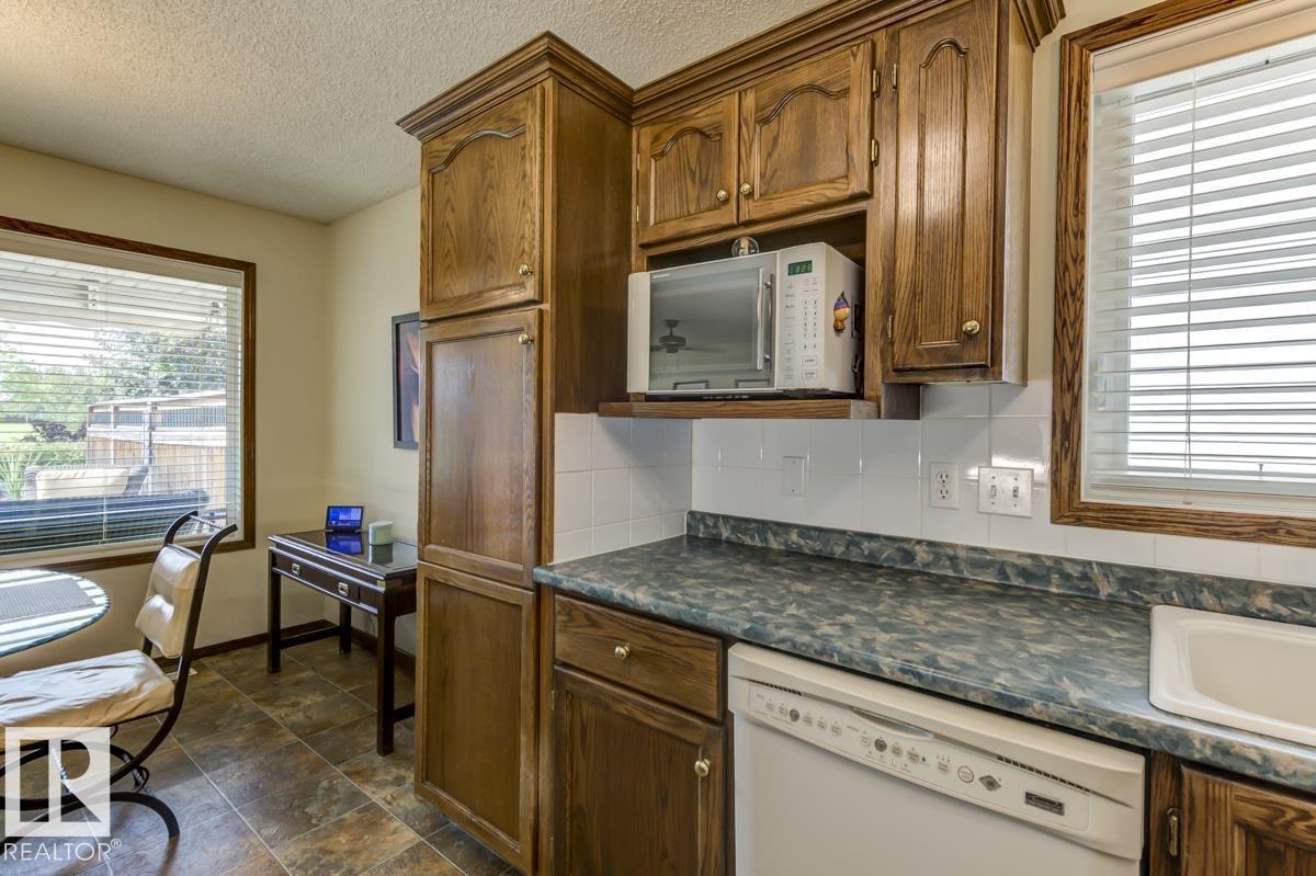 Photo 6 of 8 Regal Wy, Sherwood Park AB