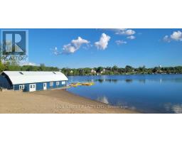 15 Hawaiian Circle, Whitchurch Stouffville, ON L0G1E0 Photo 44