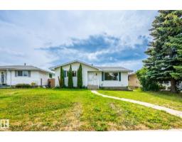 House for sale at 7543 149A Av NW, Edmonton — MLS® E4492425