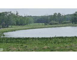 11 Twin Lakes Dr, Rural Lamont County, AB T0B2R0 Photo 51