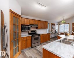 49 Heritage Dr, St  Albert, AB T8N6M7 Photo 7