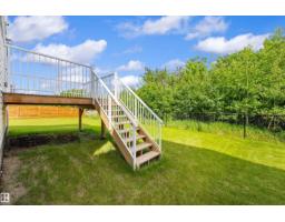 17431 7 St Ne, Edmonton, AB T5Y4E7 Photo 65