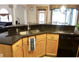 8504 160a Av Nw, Edmonton, AB T5Z3K2 Photo 11