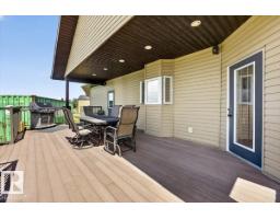 57312 Rge Road 255, Rural Sturgeon County, AB T0G1L1 Photo 45