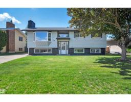 House for sale at 18 Malvern Dr, Sherwood Park — MLS® E4498341