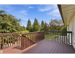 337 Twin Brooks Dr Nw, Edmonton, AB T6J6S5 Photo 22