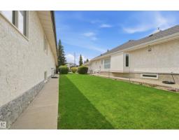 337 Twin Brooks Dr Nw, Edmonton, AB T6J6S5 Photo 55