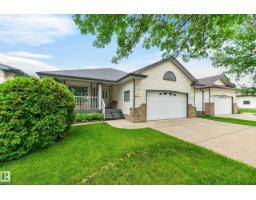 House for sale at 8011 164 Av NW, Edmonton — MLS® E4499952