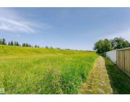 18316 78 Av Nw, Edmonton, AB T5T2A9 Photo 53