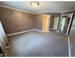 #48 6608 158 Av Nw, Edmonton, AB T5Z3H2 Photo 32