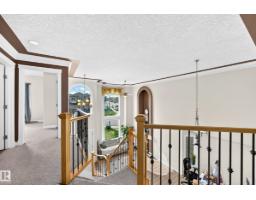 16619 72 St Nw, Edmonton, AB T5Z3Z7 Photo 28