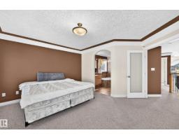16619 72 St Nw, Edmonton, AB T5Z3Z7 Photo 29