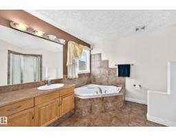 16619 72 St Nw, Edmonton, AB T5Z3Z7 Photo 32