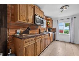 21419 Twp 542, Rural Strathcona County, AB T8L3Y8 Photo 24