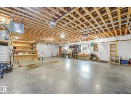 #382 51112 Rge Road 222, Rural Strathcona County, AB T8C1G9 Photo 49