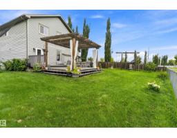 20845 92a Av Nw Nw, Edmonton, AB T5T3Z1 Photo 12