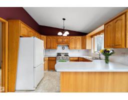 170 50470 Range Road 234, Rural Leduc County, AB T4X0L7 Photo 15
