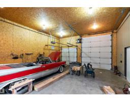 170 50470 Range Road 234, Rural Leduc County, AB T4X0L7 Photo 48
