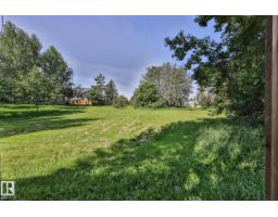 8932 187 St Nw, Edmonton, AB T5T1S1 Photo 45