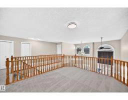 4711 152 Av Nw, Edmonton, AB T5Y3B7 Photo 48