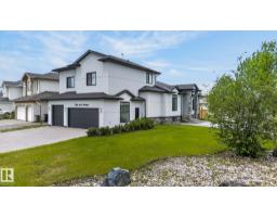 7304 164 Av Nw, Edmonton, AB T5Z3Y3 Photo 74