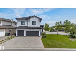 7304 164 Av Nw, Edmonton, AB T5Z3Y3 Photo 75