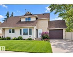 9503 180a St Nw, Edmonton, AB T5T2Z4 Photo 48