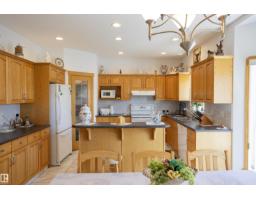 6407 163 Av Nw, Edmonton, AB T5Y3E3 Photo 22