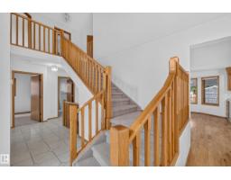 306 Twin Brooks Dr Nw, Edmonton, AB T6J6S4 Photo 34