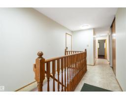 241 Oeming Rd Nw, Edmonton, AB T6R1M3 Photo 23