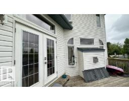 201 Foxboro Cv, Sherwood Park, AB T8A6N8 Photo 28