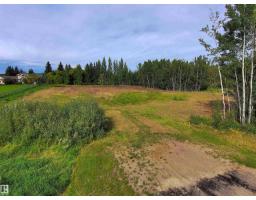 9 53420 Range Road 274, Rural Parkland County, AB T7X3T1 Photo 33