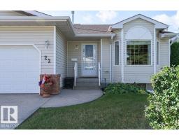 Duplex for sale at #22 7 Cranford Wy, Sherwood Park — MLS® E4509080
