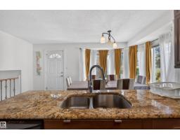 9007 169 Av Nw, Edmonton, AB T5Z2X5 Photo 13