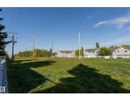 #11 115 Chestermere Dr, Sherwood Park, AB T8H2W4 Photo 30