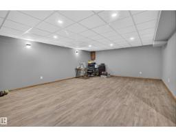 51149 Rge Road 231, Rural Strathcona County, AB T8B1K5 Photo 31