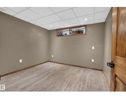 51149 Rge Road 231, Rural Strathcona County, AB T8B1K5 Photo 33