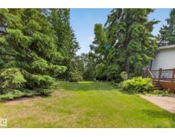 51149 Rge Road 231, Rural Strathcona County, AB T8B1K5 Photo 48