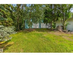 51149 Rge Road 231, Rural Strathcona County, AB T8B1K5 Photo 50