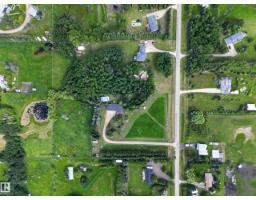51149 Rge Road 231, Rural Strathcona County, AB T8B1K5 Photo 59