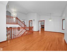 2832 36b Av Nw, Edmonton, AB T6T1N4 Photo 19