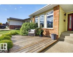 12 Greenridge Dr, Sherwood Park, AB T8A5G1 Photo 62