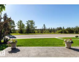 7548 110 Av Nw, Edmonton, AB T5B0A4 Photo 70