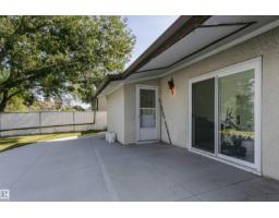 7204 92b Av Nw, Edmonton, AB T6B0W2 Photo 45