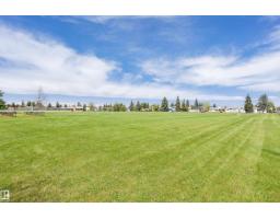 7204 92b Av Nw, Edmonton, AB T6B0W2 Photo 57