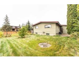 15903 111 St Nw, Edmonton, AB T5X4S5 Photo 48