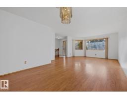 263 Oeming Rd Nw, Edmonton, AB T6R1M4 Photo 17