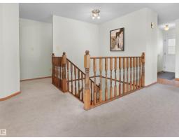 18528 98 Av Nw, Edmonton, AB T5T3J5 Photo 19